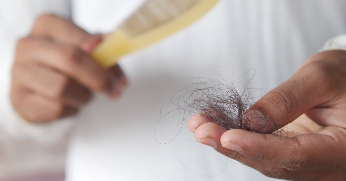 Imagem ilustrativa da queda de cabelo, fios de cabelo na mão com escova, contexto de avaliação para técnicas de transplante capilar